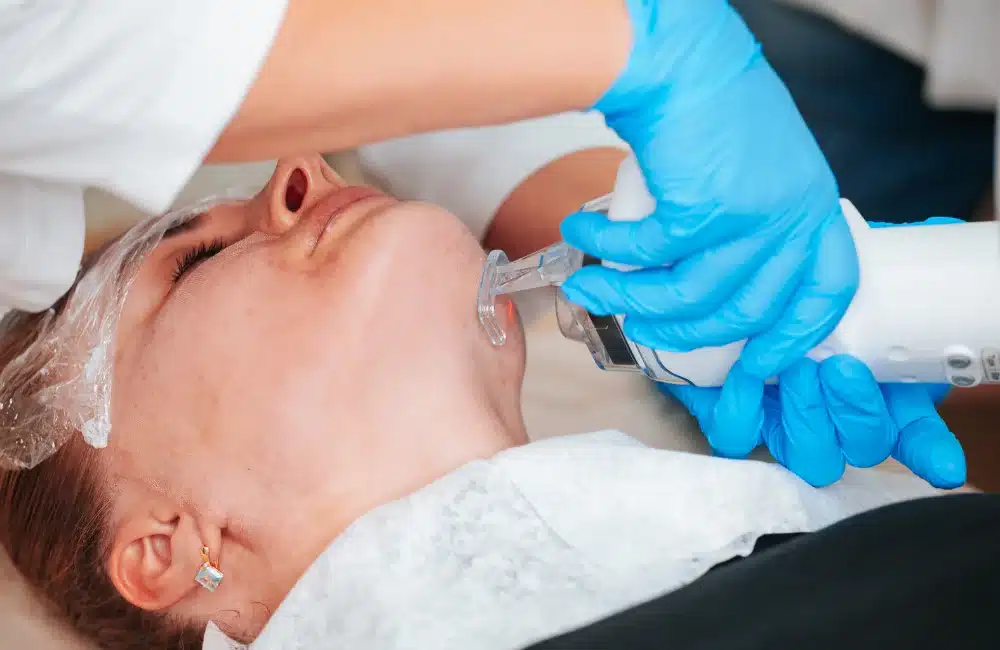 โปรแกรม Accure Laser