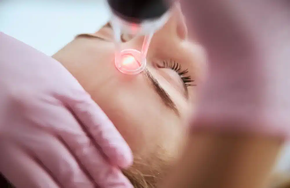 หลักการทำงานของ Accure Laser