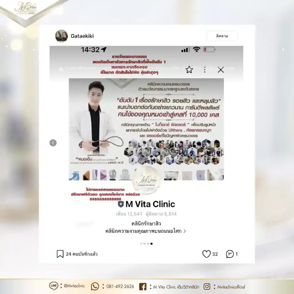 รักษาสิวไม่ทานยา-รีวิว-4-01-1024x1024