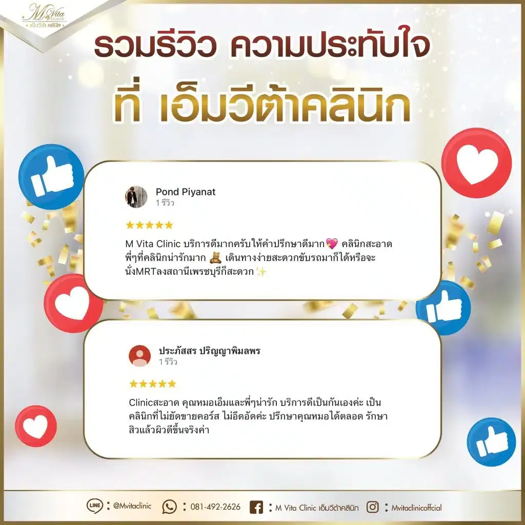 รีวิว-เอ็มวีต้า-1-1024x1024