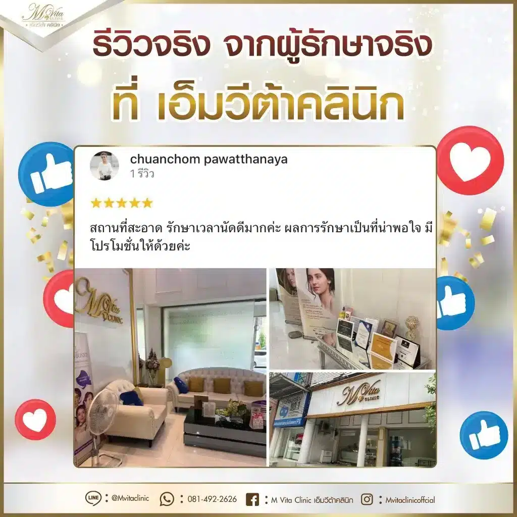 รีวิว-เอ็มวีต้า-คลินิก-11-1024x1024