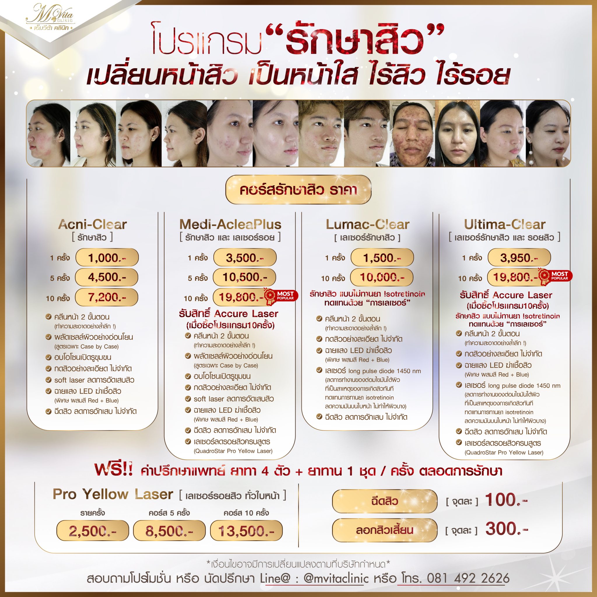 รักษาสิว ราคา