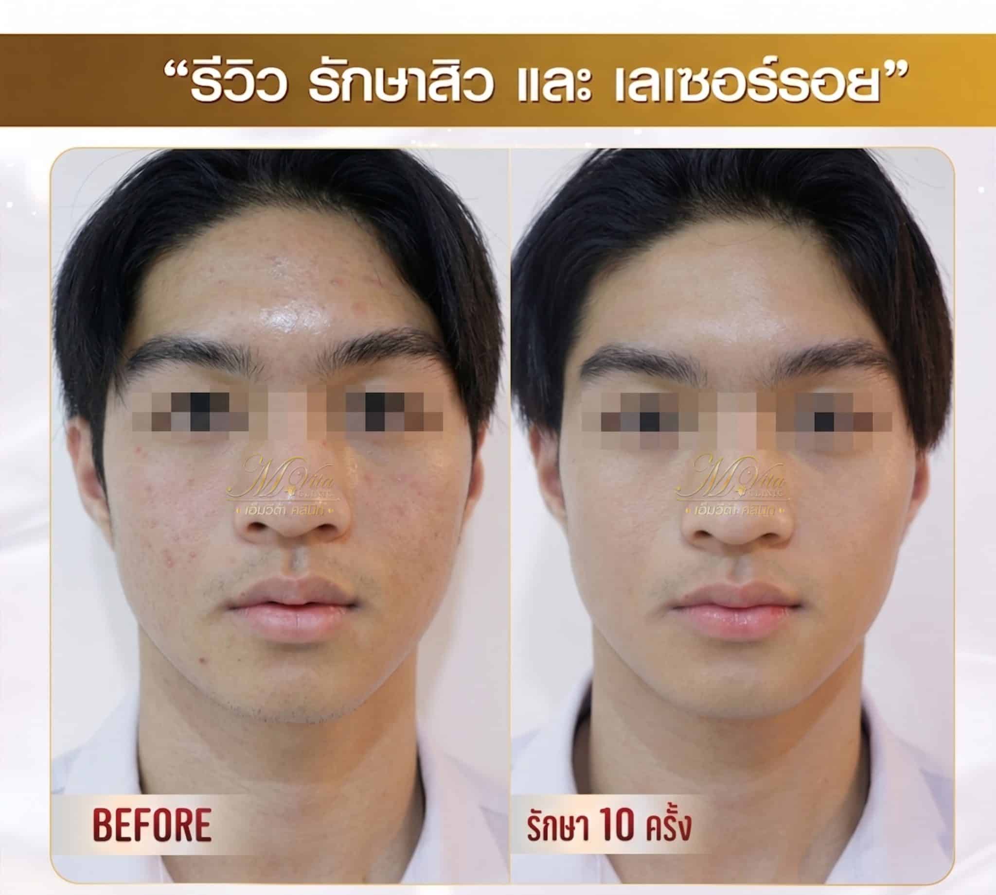รีวิวว1