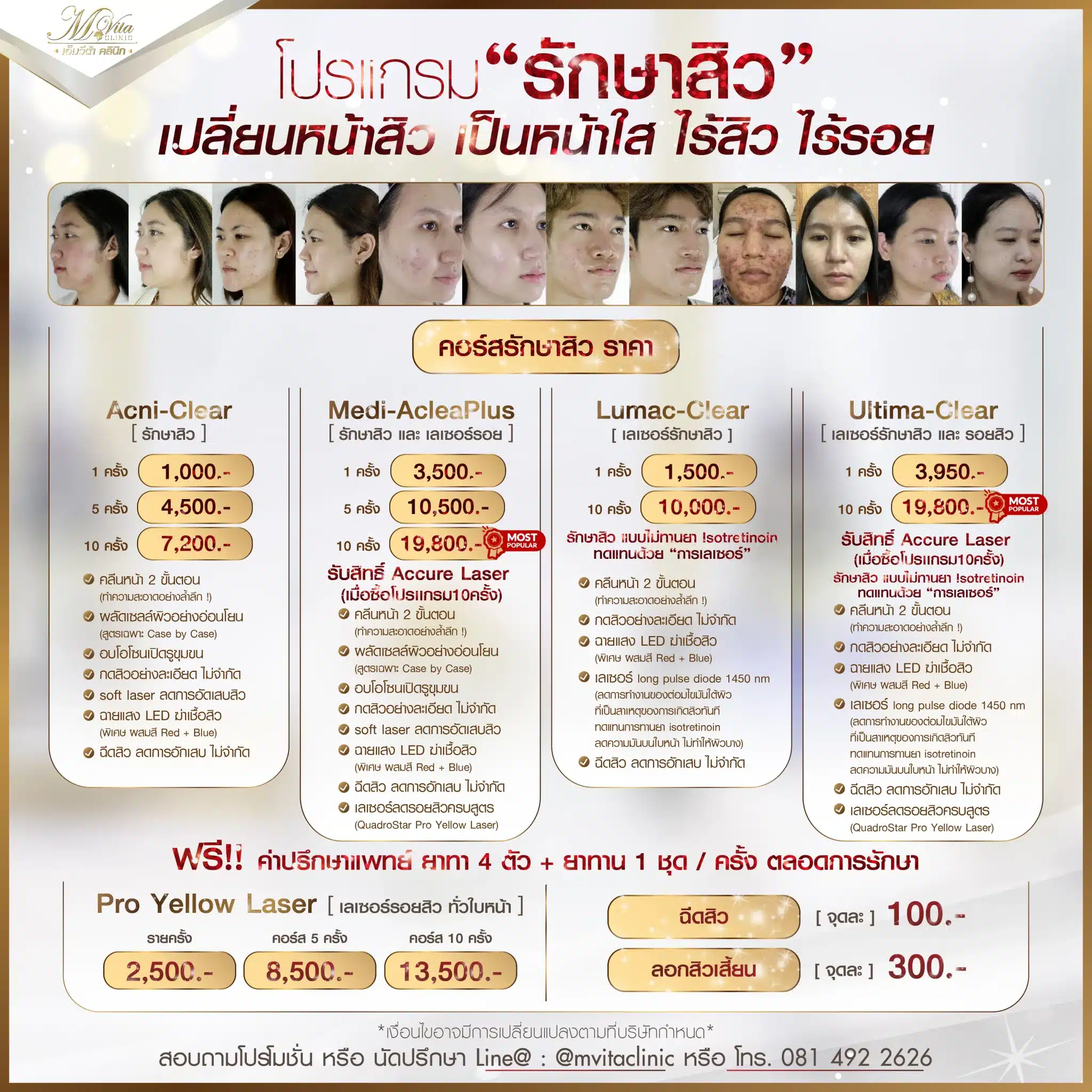รักษาสิว ราคาNew1-01