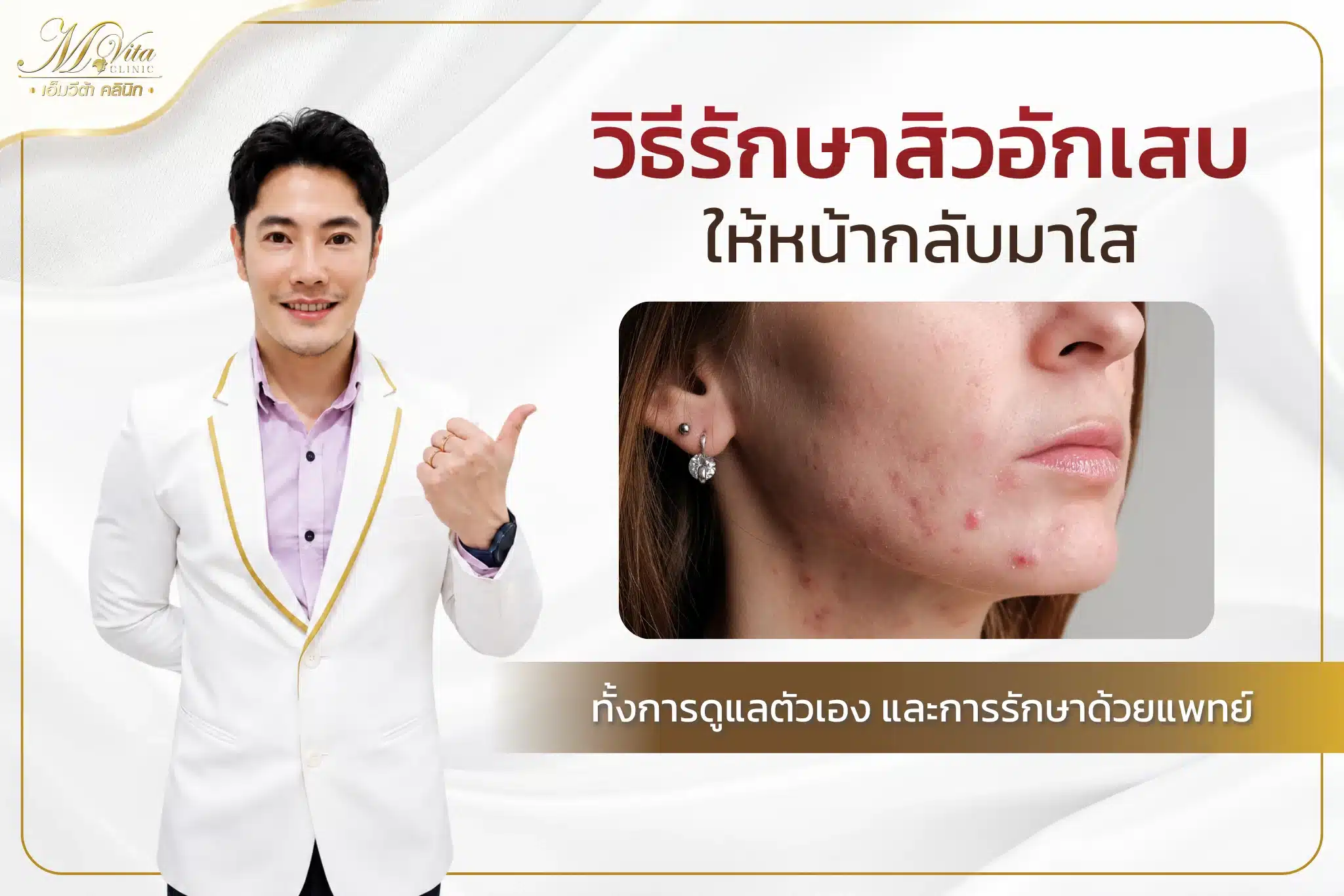 สิวอักเสบเกิดจากอะไร? พร้อมวิธีรักษาสิวอักเสบให้หน้ากลับมาใส