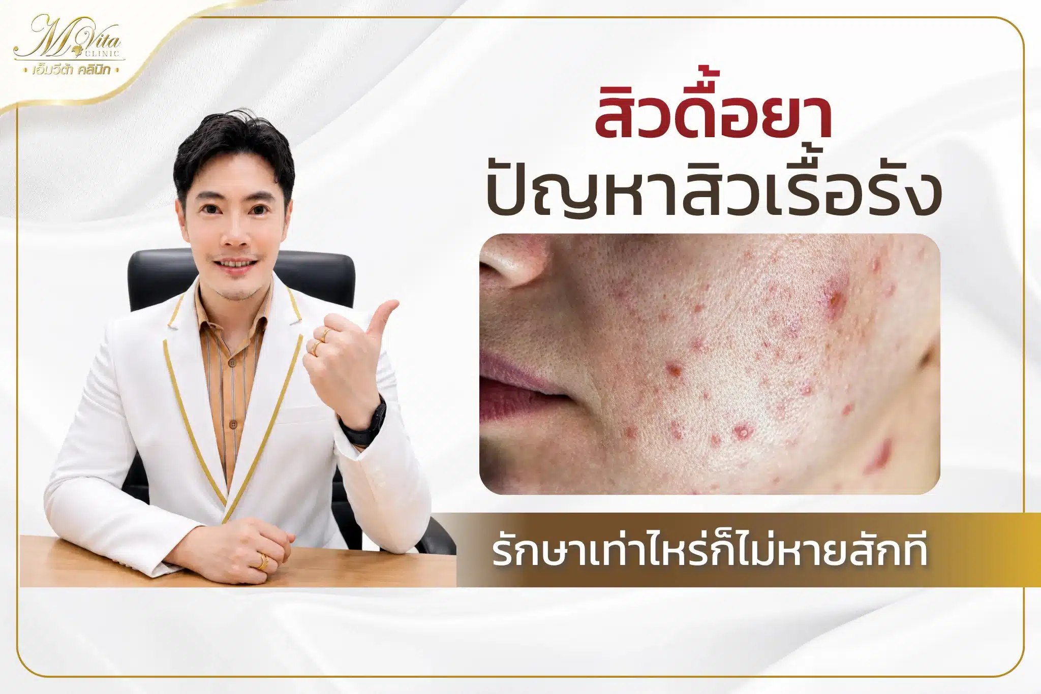 สิวดื้อยา ปัญหาของคนเป็นสิวเรื้อรัง รักษาเท่าไหร่ก็ไม่หายสักที