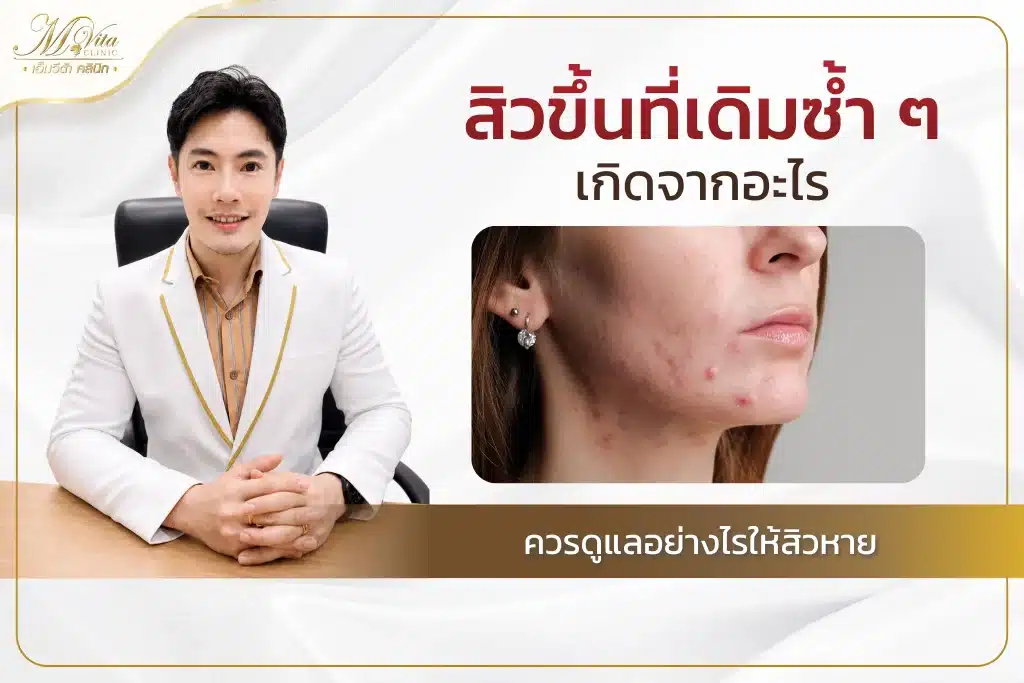 สิวขึ้นที่เดิม
