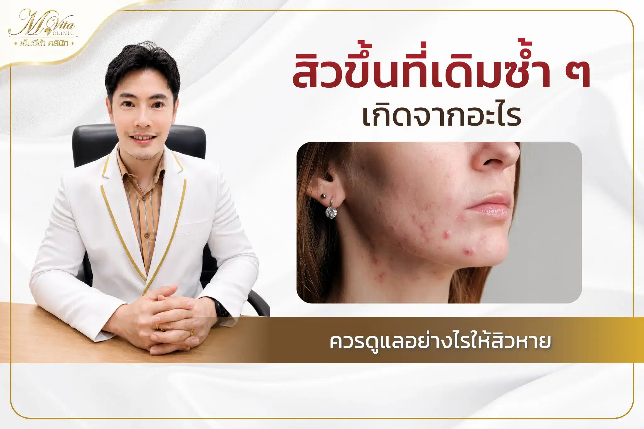 สิวขึ้นที่เดิม