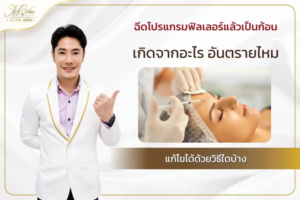 ฉีดโปรแกรมฟิลเลอร์แล้วเป็นก้อน