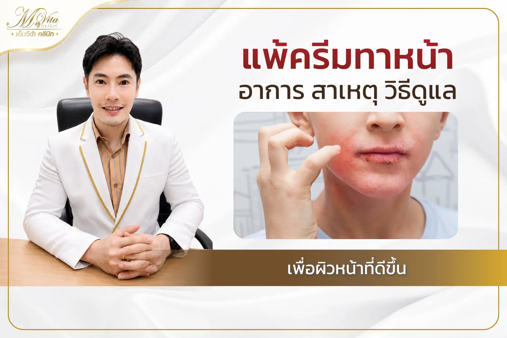 อาการแพ้ครีมทาหน้า