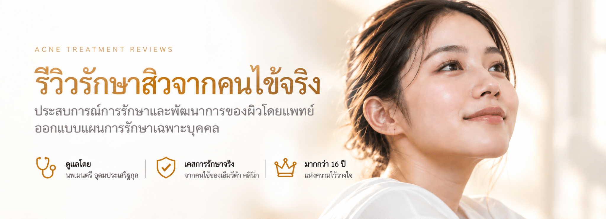 รีวิวรักษาสิว